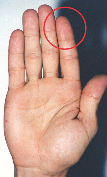 חסך בקשר אב