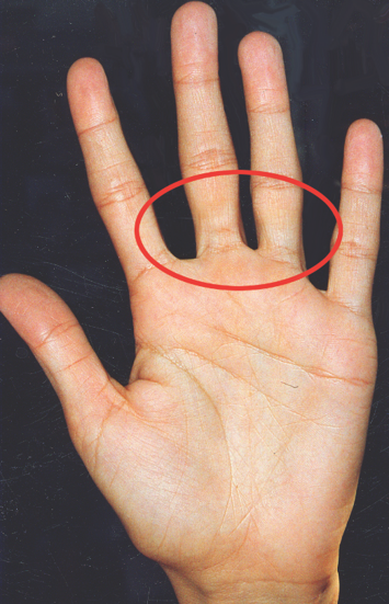 ראציונליזציות ואינטלקטואליזציות